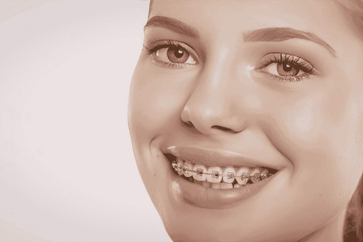 Braces dental treatment