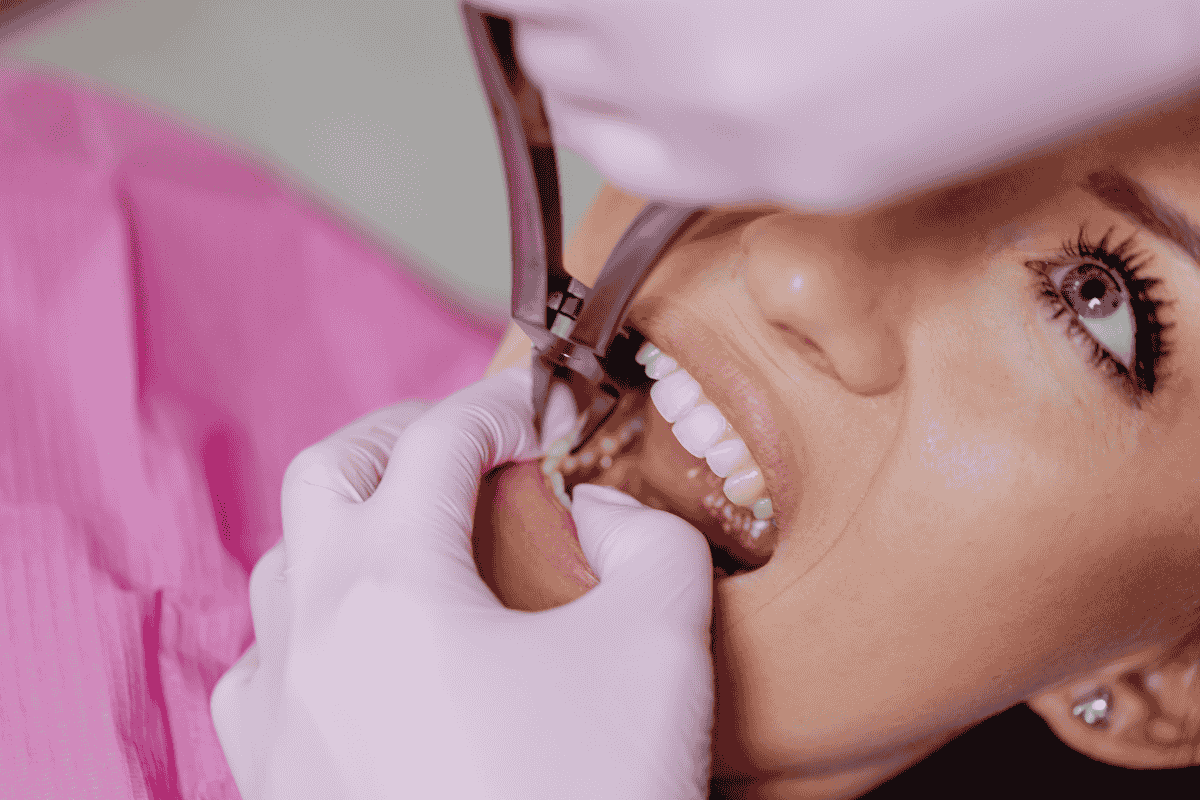 Tooth extraction treatment