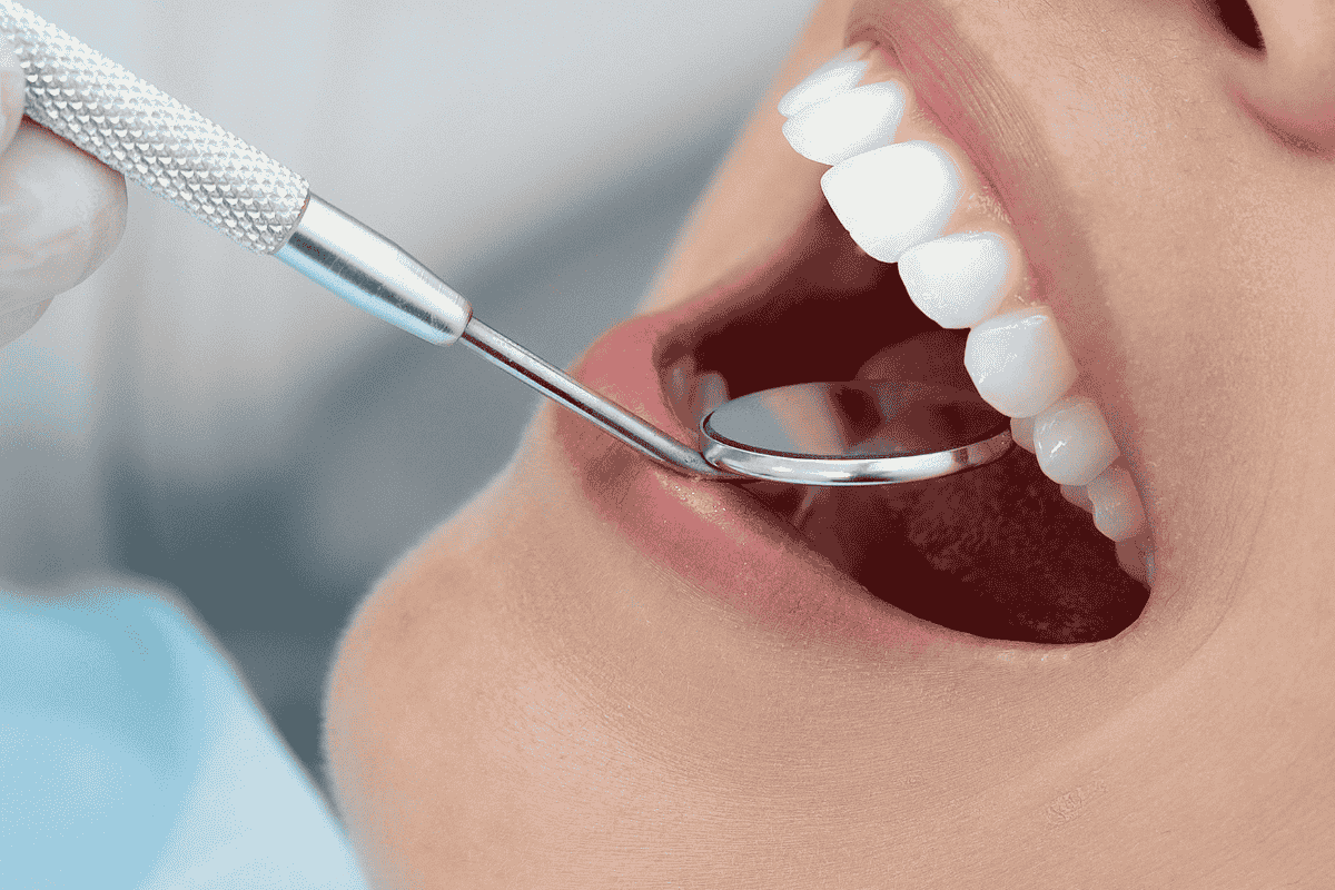Tooth filling treatment